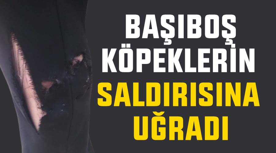 Başıboş köpeklerin saldırısına uğradı