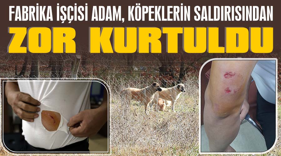 Fabrika işçisi adam, köpeklerin saldırısından zor kurtuldu